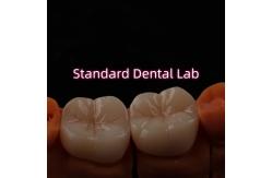 China Full Contour Bruxier Monolithic Zirconia Crown Bridge Dental Lab supplier