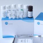 Fsc Certified Elisa Kit Human Ifnw1 Interferon Omega-1 for sale