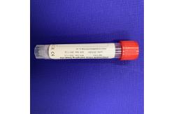 China Virus Test 152mm Medical Cotton Swab , Non Invasive Nasal Swab supplier