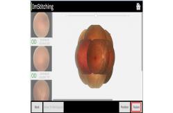 China 3.5mm Digital Fundus Camera Equipment Avoid Glaucoma supplier
