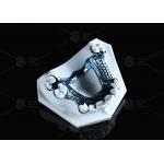 Hypoallergenic Adjustable And Customizable 3D Printed Titanium Framework With Modern Design