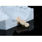 Translucency White Full Contour Zirconia Crown FCZ Monolithic Zirconia Crown Easy Milling