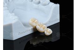 China Translucency White Full Contour Zirconia Crown FCZ Monolithic Zirconia Crown Easy Milling supplier