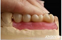 China Ultra-precision processing Zirconia Implants All-Zirconium Integrated Crown supplier