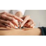 0.16mm Silver Intradermal Acupuncture Needles For Pain Relief for sale