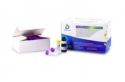 China Simple Operate Men'S Fertility Test Kit Semen Leukocytes Test Kit Peroxidase Staining supplier