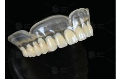 China Heat Curing Vertex Thermosens Dentures For Clear Full Denture Wearers supplier