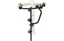 China Condylar External Fixation Device supplier