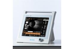 China Digital 60 Hz Ultrasonic Scanner Accurate Detection For Ophthalmology supplier