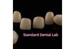 China Dental Strong Layered Zirconia Crowns Full Upper Arch Restoration supplier
