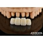 Biologically Oriented Preparation Technique BOPT For Accurate Dental Preparation