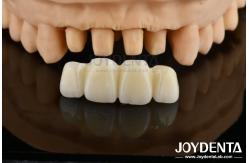China Biologically Oriented Preparation Technique BOPT For Accurate Dental Preparation supplier