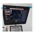 EPIQ 5 Ultrasound Machine Repair Dark Channels In The Sound Area Replace ACQ