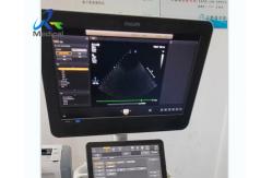 China EPIQ 5 Ultrasound Machine Repair Dark Channels In The Sound Area Replace ACQ supplier