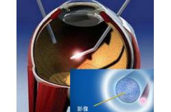 China Medical Endoscope Sapphire Optical Window , 25mm Sapphire Lens Protector supplier