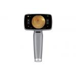 Portable HFC Digital Fundus Camera Ophthalmic Equipment