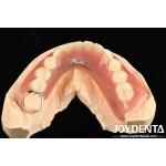 Metals And Resins Framework Set Up Teeth Finish For Stable Oral Structure In Dental Configuration for sale