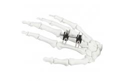 China Orthopedic Surgical Mini Fragment Ilizarov External Fixation Device supplier