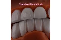 China Lithium Dicilicate layer Ivoclar Emax Zirconia Laminate Veneers Translucent OEM ODM supplier