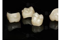 China Natural Full Contour Zirconia Crown Precise Fit Full Contour Dental Lab supplier