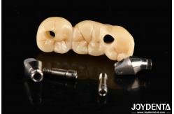 China Implant Crown And Bridge With Customizable Design High Durability Accurate Fit supplier