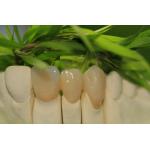 Prosthetic Dentistry Full Zirconium Oxide Crown 5 Stars Design Dental Lab for sale