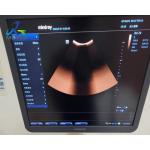 Doppler Ultrasound Machine Repair Solutions Mindray DC-70 Dark Shadows In The Image Of The Echo Zone for sale
