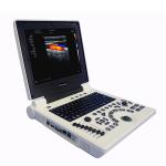Best Cheap Price Medical Ultrasound Diagnostic System Laptop Portable Color Doppler Ultrasound Machine for Hospital for sale