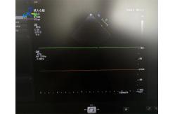China GE S8-3 Ultrasound Probe Transducer Maintenance Image With Error supplier