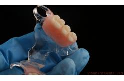China Flexible Clear Metal Cast Framework Partial Dentures High Esthetics Perfect Fit supplier