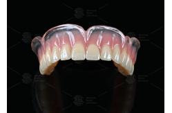 China Vertex Clear And Pink Full Denture Virtually Unbreakable Affordable Partial Dentures supplier