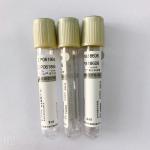 Evacuated Vacuum Blood Collection Tube  Glucose Tolerance Test Use for sale