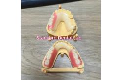 China Esthetic Tooth Shade Acetal Framework  Tooth Coloured Clasps Ivoclar Set Up supplier