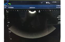 China Toshiba PVT-712BT 11MC4 Micro-Convex Ultrasound Probe/Neonatal imaging supplier