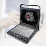 Sonoscape S9 Pregnant Baby Medical Diagnosis 4D Color Doppler Sonography Machine Portable Ultrasound for sale