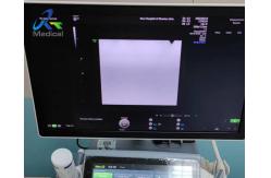 China Medical Ultrasound Machine Repair GE Voluson E8 Absence Of Bright Track Interference supplier