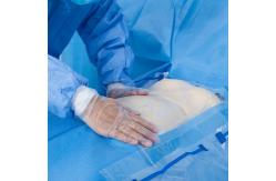 China Disposable Surgical Caesarean Drape With Fluid Repellent Function And Anti Tear Treatment supplier