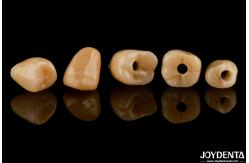 China Customizable Implant Crown and Bridge Achieve a Natural Look with Long-lasting Results supplier
