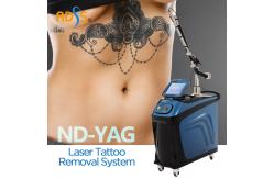 China Laser Pigmentation Removal Machine 532nm 1064nm Permanent Tattoo Removal Machine supplier