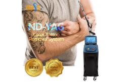 China Long Pulse ND YAG Laser Machine 1064nm Laser Pigmentation Removal Machine supplier
