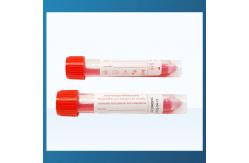 China HCY virus sampling tube disposable virus sampling tube set sampling tube supplier