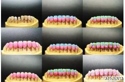 China Advanced Ceramic Porcelain Veneers Biocompatible Shade Matched for a Natural Smile supplier