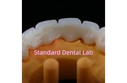 China CAD CAM Mill Zirconia Crown Bridge Highly Biocompatible supplier