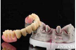 China Advanced Dental Metallic Material For Supporting Mastication Needs supplier
