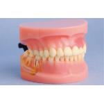 China Model of Periodontal Disease Human Teeth Model for Medical Colleges and Clinic Training for sale