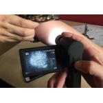 Handheld Dermatoscope Digital Skin Analyzer 5M Pixels Supported PC of Window System for sale