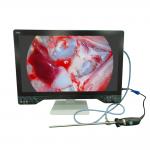 Ultra High Definition Endoscope Camera 4K For Laparoscopy With 32 Monitor And Light Source for sale