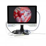 15-inch Monitor Mode Selection TUYOU All-in-One Medical Endoscope Camera with Light Source for Urology and Gynecology for sale