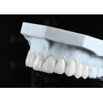 Translucency CAD EMAX Veneer Polished Glazed Ceramic Restorations For Anterior Posterior Areas for sale