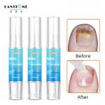 Butanediol Fungal Lanthome Fungal Nail Treatment Pen 4ml for sale